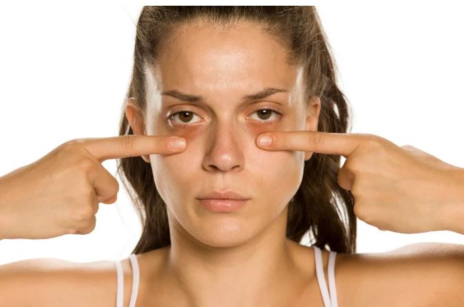 ¿Por Qué Tengo Ojeras Aunque Duerma Bien?